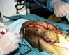 Mammary tumours